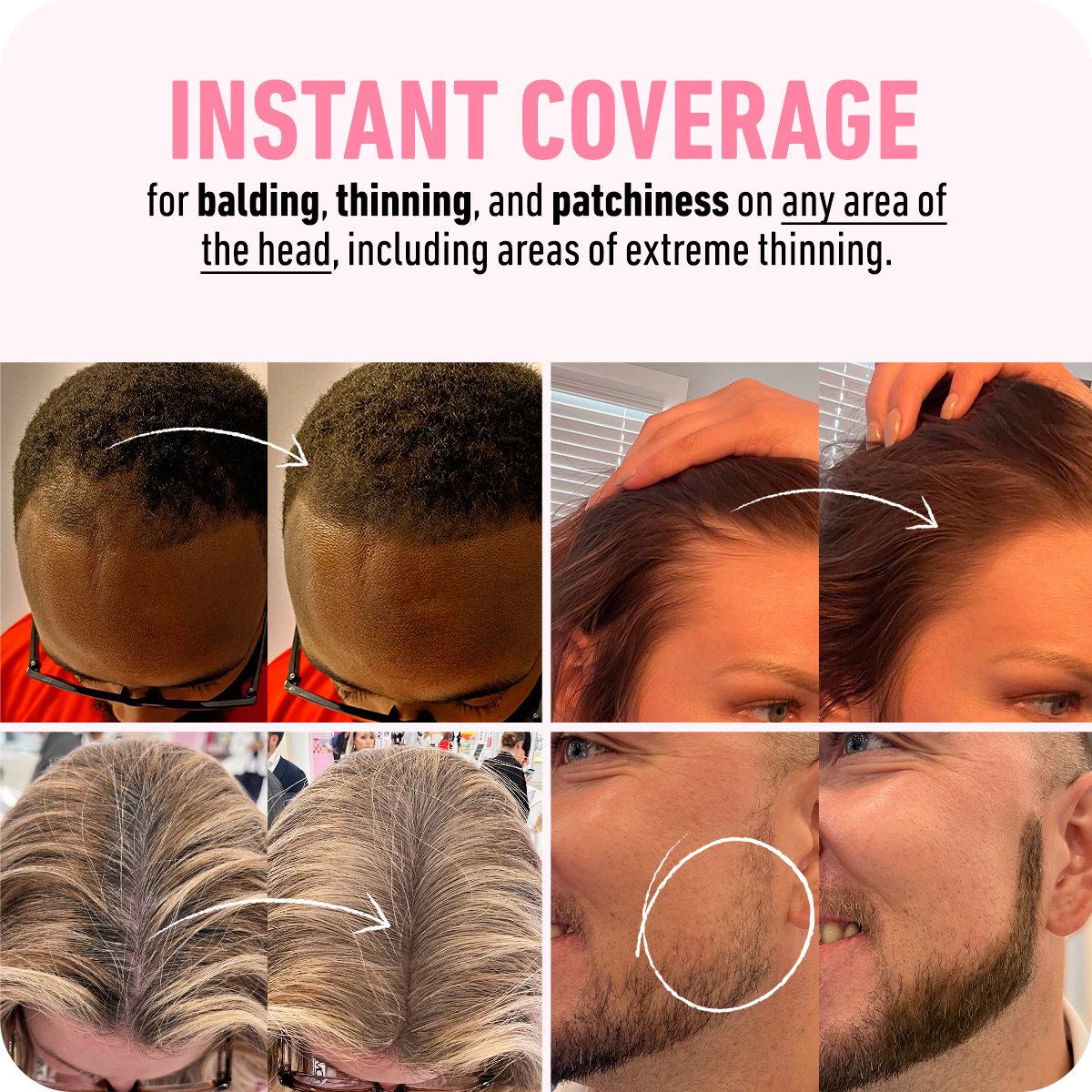 Magic Hair - Resultado Instantâneo