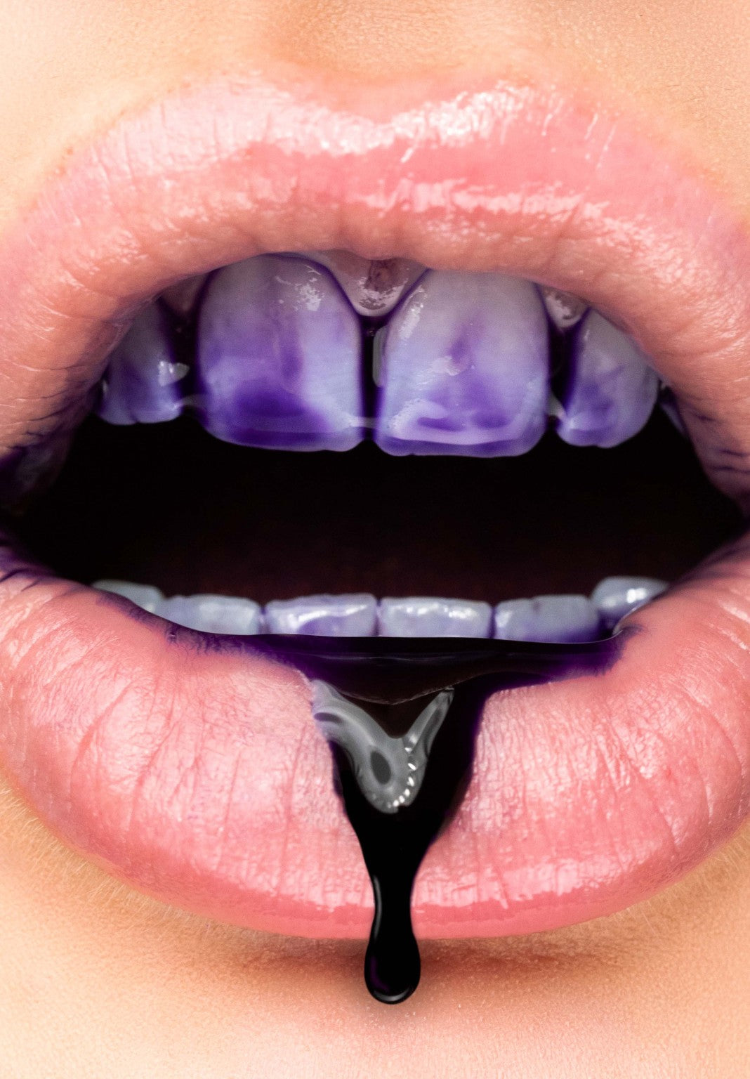 BrightSmile [V34]® - Clareamento Dental Instantâneo