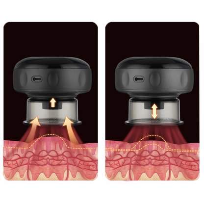 Smart Cupper Detox™