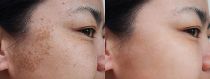 Creme Clareador Perfect Skin