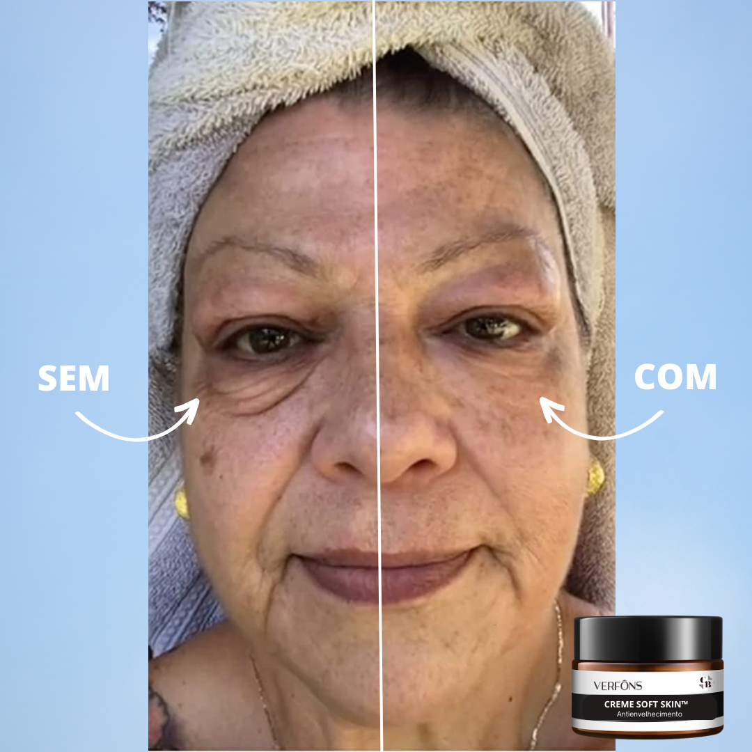 Soft Skin Cream - Anti-aging 