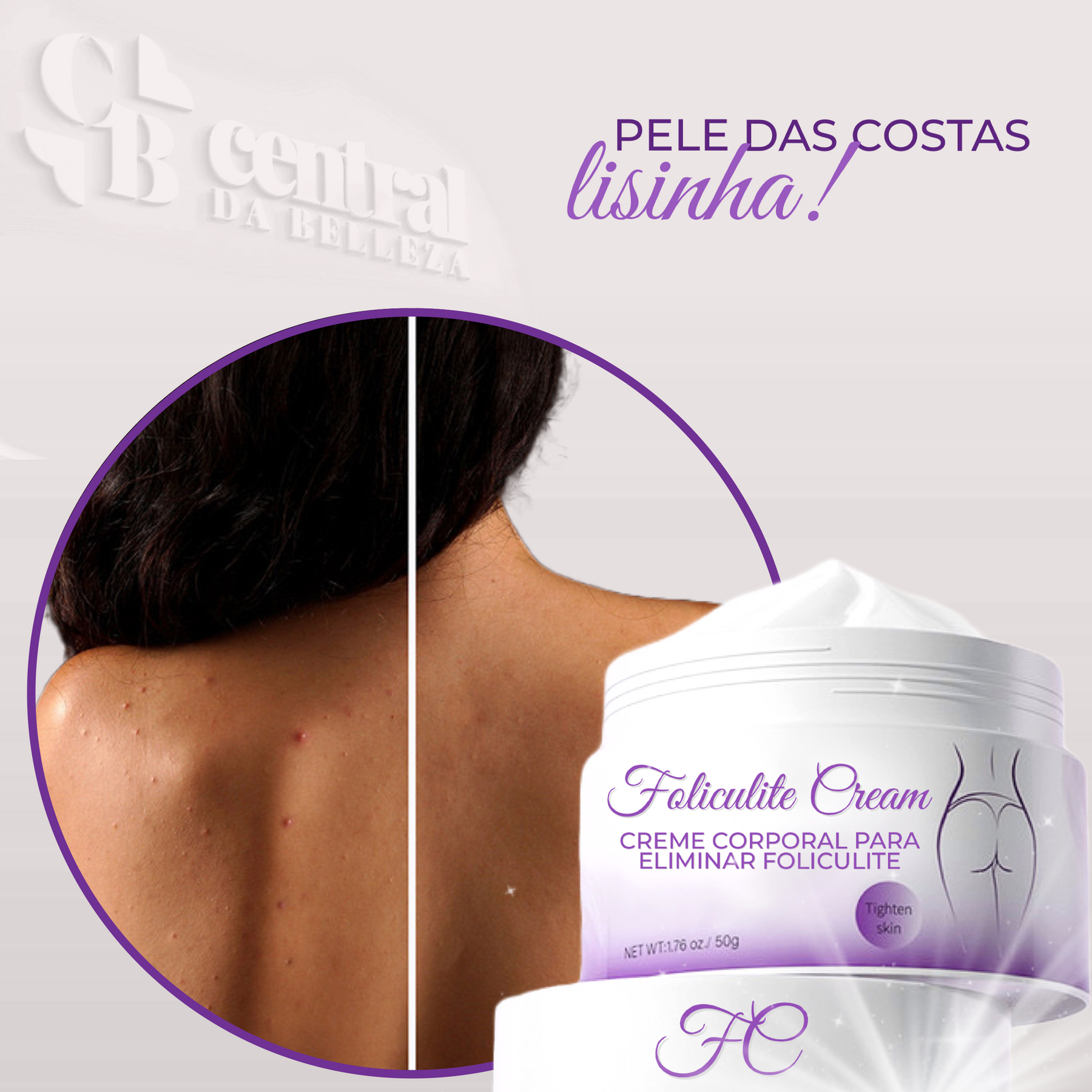 Folicure Cream - Body Cream for Folliculitis 