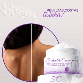 Folicure Cream - Body Cream for Folliculitis 