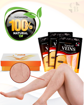 VARICEL - 100% Natural Varicose Vein Treatment 