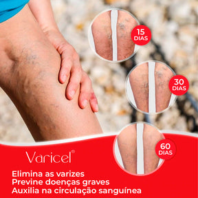 VARICEL - 100% Natural Varicose Vein Treatment 