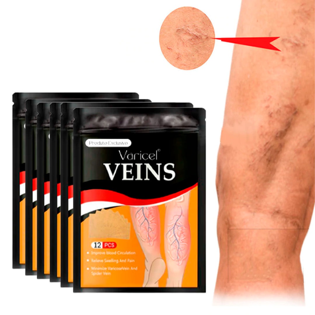 VARICEL - 100% Natural Varicose Vein Treatment 